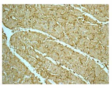 Immunohistochemistry (Formalin/PFA-fixed paraffin-embedded sections) - Anti-Superoxide Dismutase 3/EC-SOD antibody [EPR10860] (AB171738)
