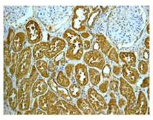 Immunohistochemistry (Formalin/PFA-fixed paraffin-embedded sections) - Anti-Superoxide Dismutase 3/EC-SOD antibody [EPR10860] (AB171738)