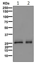 Western blot - Anti-Superoxide Dismutase 3/EC-SOD antibody [EPR10860] - BSA and Azide free (AB249643)