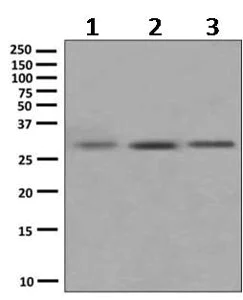 Western blot - Anti-Superoxide Dismutase 4/CCS antibody [EPR9712] - BSA and Azide free (AB249412)