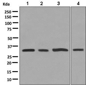 Western blot - Anti-Superoxide Dismutase 4/CCS antibody [EPR9713(B)] (AB137131)