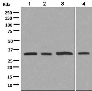 Western blot - Anti-Superoxide Dismutase 4/CCS antibody [EPR9713(B)] - BSA and Azide free (AB248839)