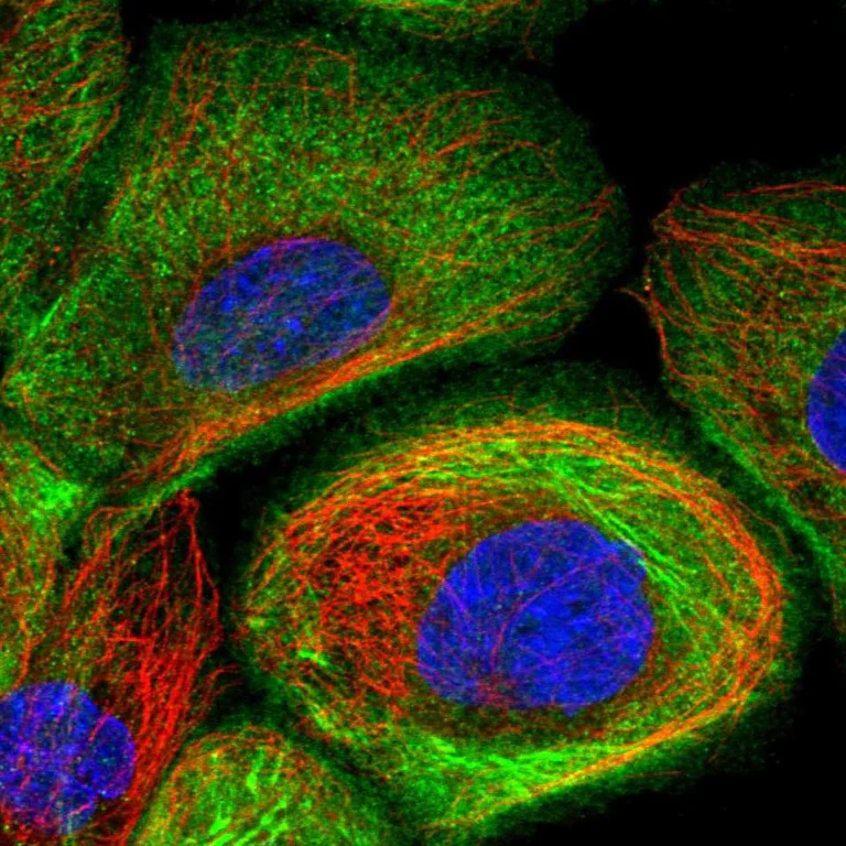 Immunocytochemistry/ Immunofluorescence - Anti-Supervillin antibody (AB254629)