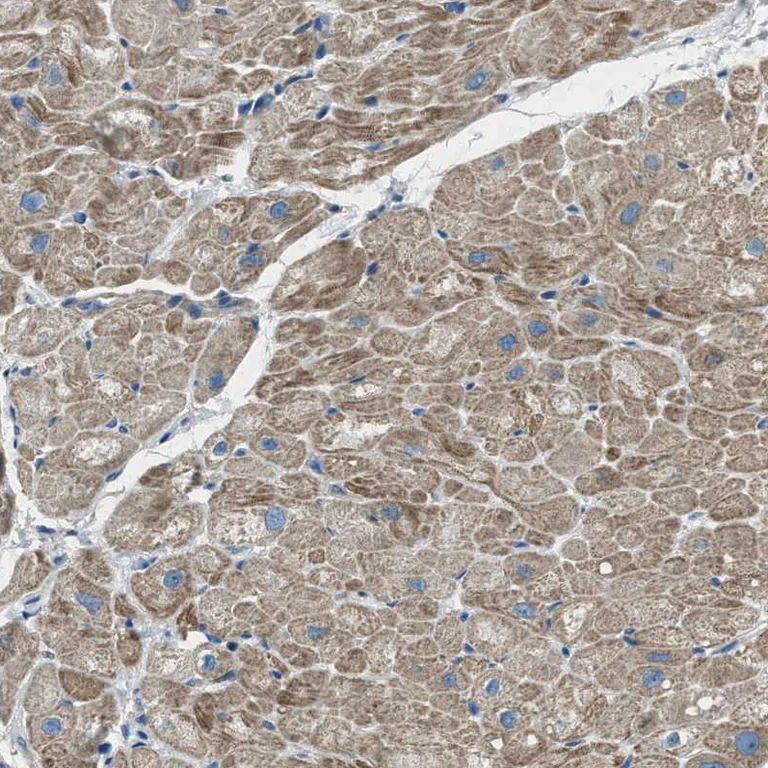 Immunohistochemistry (Formalin/PFA-fixed paraffin-embedded sections) - Anti-Supervillin antibody (AB254629)