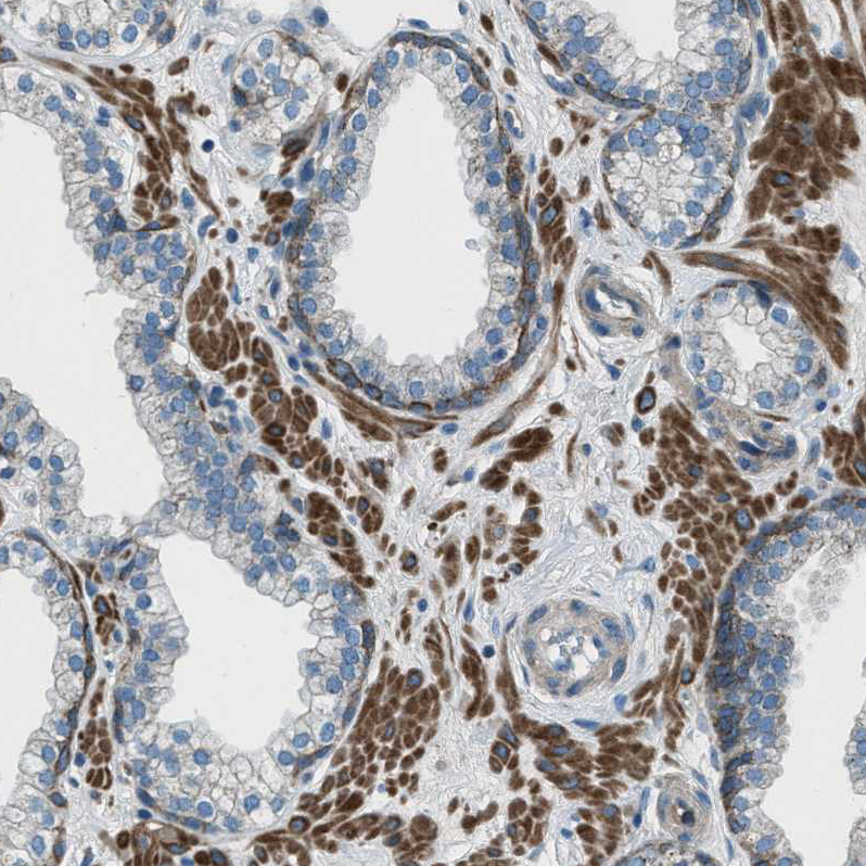Immunohistochemistry (Formalin/PFA-fixed paraffin-embedded sections) - Anti-Supervillin antibody (AB254629), expandable thumbnail