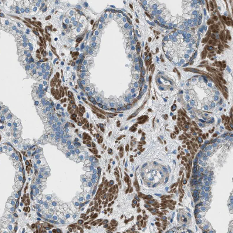 Immunohistochemistry (Formalin/PFA-fixed paraffin-embedded sections) - Anti-Supervillin antibody (AB254629)