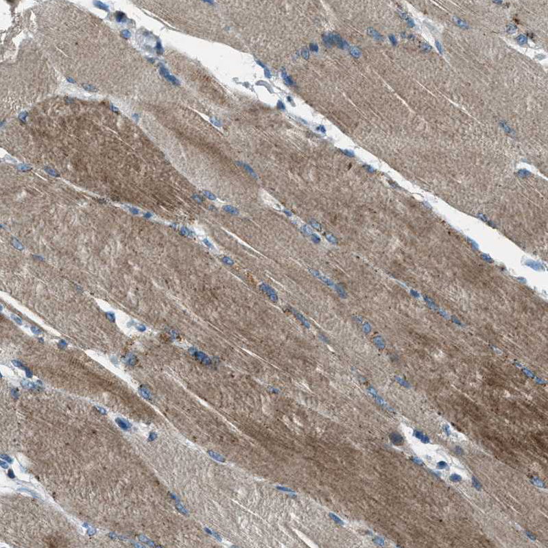 Immunohistochemistry (Formalin/PFA-fixed paraffin-embedded sections) - Anti-Supervillin antibody (AB254629), expandable thumbnail