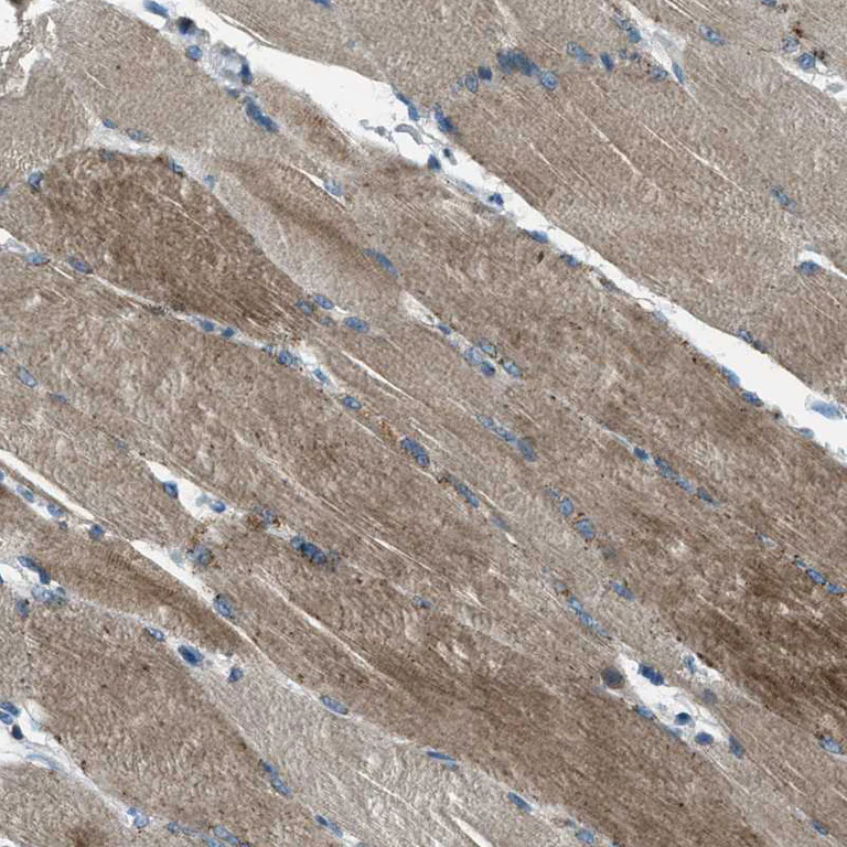 Immunohistochemistry (Formalin/PFA-fixed paraffin-embedded sections) - Anti-Supervillin antibody (AB254629)