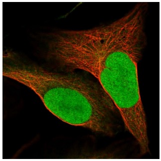 Immunocytochemistry/ Immunofluorescence - Anti-SUPT16H antibody (AB204343), expandable thumbnail