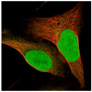 Immunocytochemistry/ Immunofluorescence - Anti-SUPT16H antibody (AB204343)