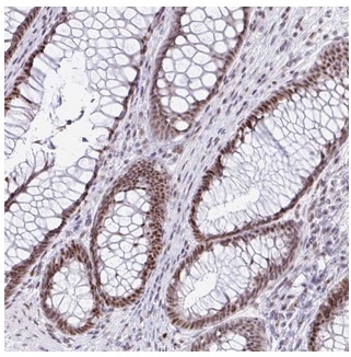 Immunohistochemistry (Formalin/PFA-fixed paraffin-embedded sections) - Anti-SUPT16H antibody (AB204343), expandable thumbnail