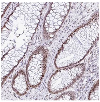 Immunohistochemistry (Formalin/PFA-fixed paraffin-embedded sections) - Anti-SUPT16H antibody (AB204343)