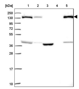 Western blot - Anti-SUPT16H antibody (AB204343), expandable thumbnail