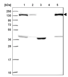 Western blot - Anti-SUPT16H antibody (AB204343)
