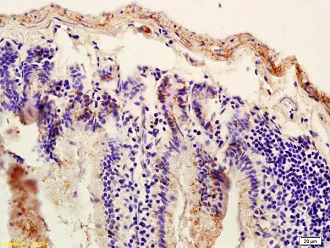Immunohistochemistry (Formalin/PFA-fixed paraffin-embedded sections) - Anti-SUR1 antibody (AB217633)