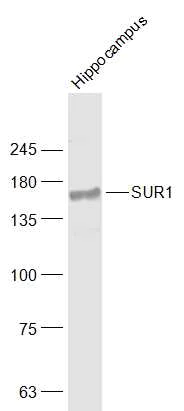 Western blot - Anti-SUR1 antibody (AB217633)