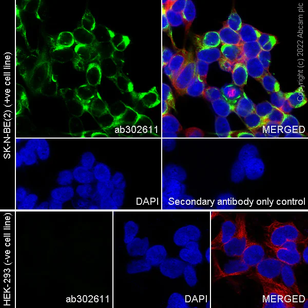 Immunocytochemistry/ Immunofluorescence - Anti-SUR1 antibody [EPR25761-44] (AB302611)