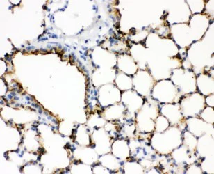 Immunohistochemistry (Formalin/PFA-fixed paraffin-embedded sections) - Anti-Surfactant Protein A/PSAP antibody (AB115791)