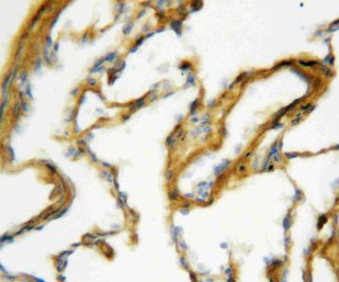 Immunohistochemistry (Formalin/PFA-fixed paraffin-embedded sections) - Anti-Surfactant Protein A/PSAP antibody (AB115791)