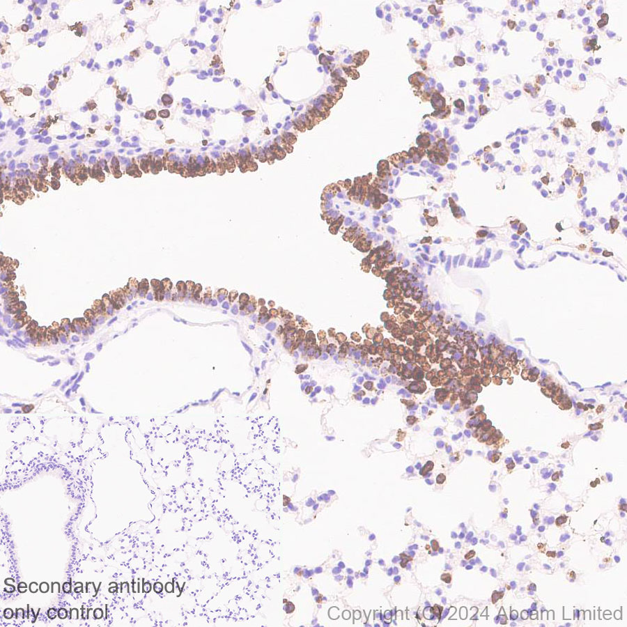 Immunohistochemistry (Formalin/PFA-fixed paraffin-embedded sections) - Anti-Surfactant Protein A/PSAP antibody [EPR29097-290] (ab322404), expandable thumbnail