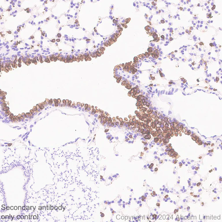 Immunohistochemistry (Formalin/PFA-fixed paraffin-embedded sections) - Anti-Surfactant Protein A/PSAP antibody [EPR29097-290] (AB322404)
