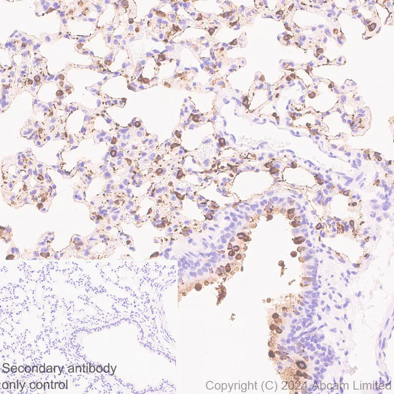 Immunohistochemistry (Formalin/PFA-fixed paraffin-embedded sections) - Anti-Surfactant Protein A/PSAP antibody [EPR29097-290] (AB322404)