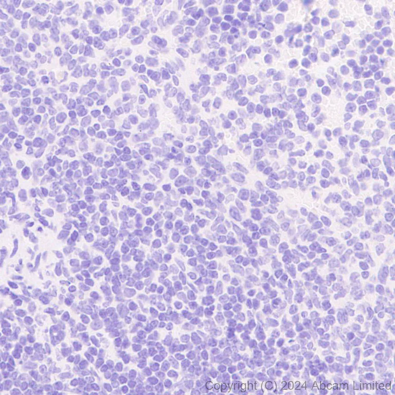 Immunohistochemistry (Formalin/PFA-fixed paraffin-embedded sections) - Anti-Surfactant Protein A/PSAP antibody [EPR29097-290] (AB322404)