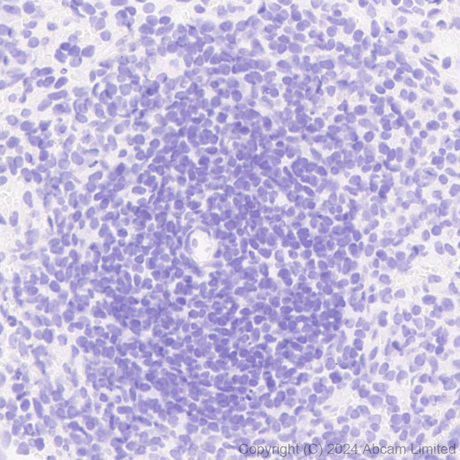 Immunohistochemistry (Formalin/PFA-fixed paraffin-embedded sections) - Anti-Surfactant Protein A/PSAP antibody [EPR29097-290] (AB322404), expandable thumbnail