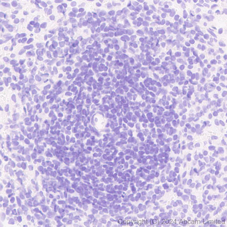 Immunohistochemistry (Formalin/PFA-fixed paraffin-embedded sections) - Anti-Surfactant Protein A/PSAP antibody [EPR29097-290] (AB322404)