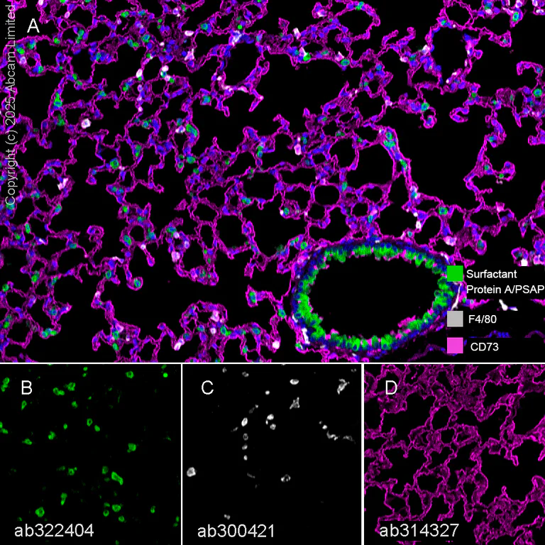 Multiplex immunohistochemistry - Anti-Surfactant Protein A/PSAP antibody [EPR29097-290] (AB322404)