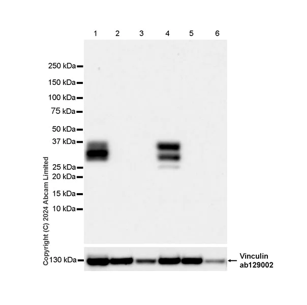 Western blot - Anti-Surfactant Protein A/PSAP antibody [EPR29097-290] (AB322404)