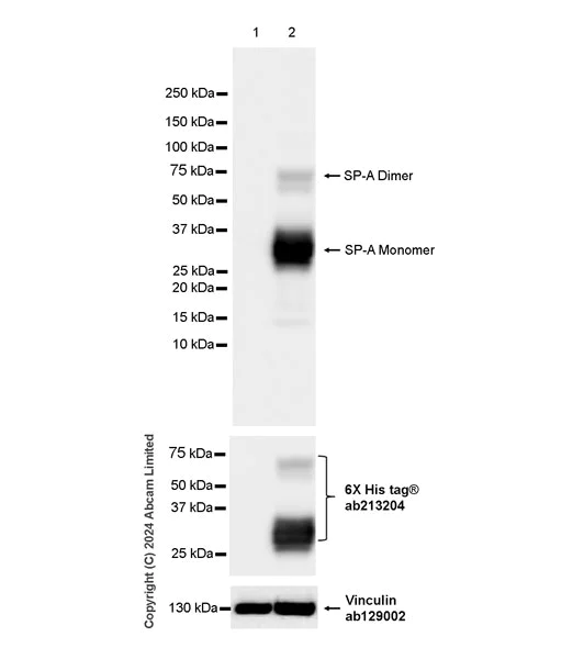 Western blot - Anti-Surfactant Protein A/PSAP antibody [EPR29097-290] (AB322404)