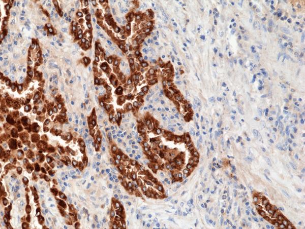 Immunohistochemistry (Formalin/PFA-fixed paraffin-embedded sections) - Anti-Surfactant Protein B antibody [RM370] (AB271345)