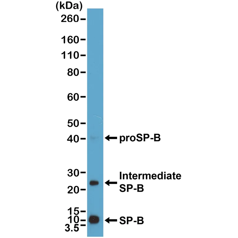 Western blot - Anti-Surfactant Protein B antibody [RM370] (AB271345)