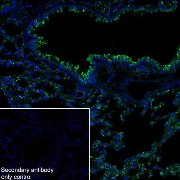 Immunohistochemistry (Frozen sections) - Anti-Surfactant protein D/SP-D antibody [EPR21774-153] (AB220422)