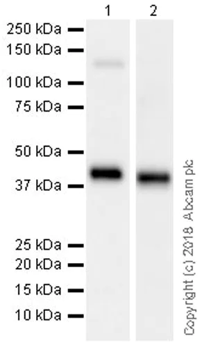 Western blot - Anti-Surfactant protein D/SP-D antibody [EPR21774-153] (AB220422)
