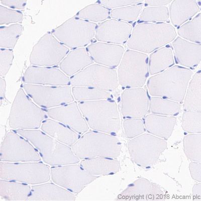 Immunohistochemistry (Formalin/PFA-fixed paraffin-embedded sections) - Anti-Surfactant protein D/SP-D antibody [EPR21774-153] - BSA and Azide free (AB234260)
