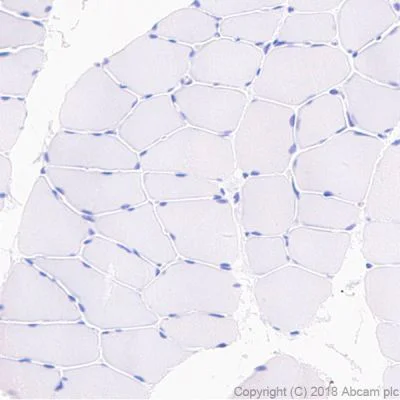 Immunohistochemistry (Formalin/PFA-fixed paraffin-embedded sections) - Anti-Surfactant protein D/SP-D antibody [EPR21774-153] - BSA and Azide free (AB234260)
