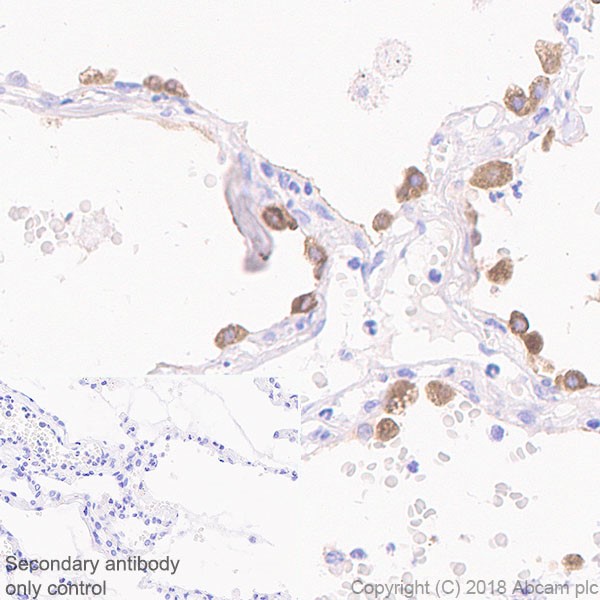 Immunohistochemistry (Formalin/PFA-fixed paraffin-embedded sections) - Anti-Surfactant protein D/SP-D antibody [EPR21928-209] (AB220423)