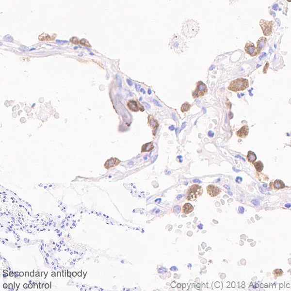 Immunohistochemistry (Formalin/PFA-fixed paraffin-embedded sections) - Anti-Surfactant protein D/SP-D antibody [EPR21928-209] (AB220423)