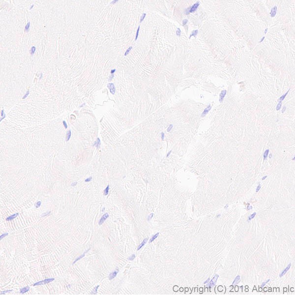 Immunohistochemistry (Formalin/PFA-fixed paraffin-embedded sections) - Anti-Surfactant protein D/SP-D antibody [EPR21928-209] - BSA and Azide free (AB234257)