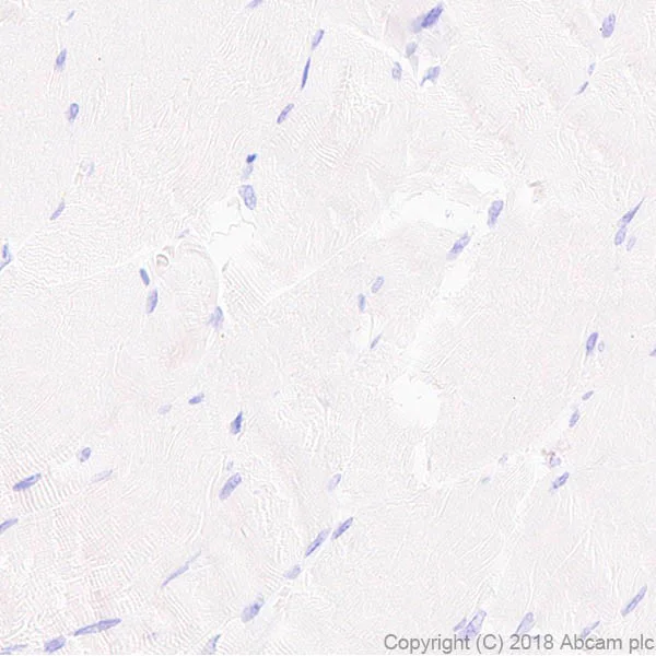 Immunohistochemistry (Formalin/PFA-fixed paraffin-embedded sections) - Anti-Surfactant protein D/SP-D antibody [EPR21928-209] - BSA and Azide free (AB234257)