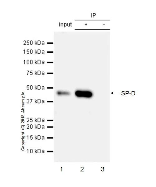 Immunoprecipitation - Anti-Surfactant protein D/SP-D antibody [EPR21928-209] - BSA and Azide free (AB234257)