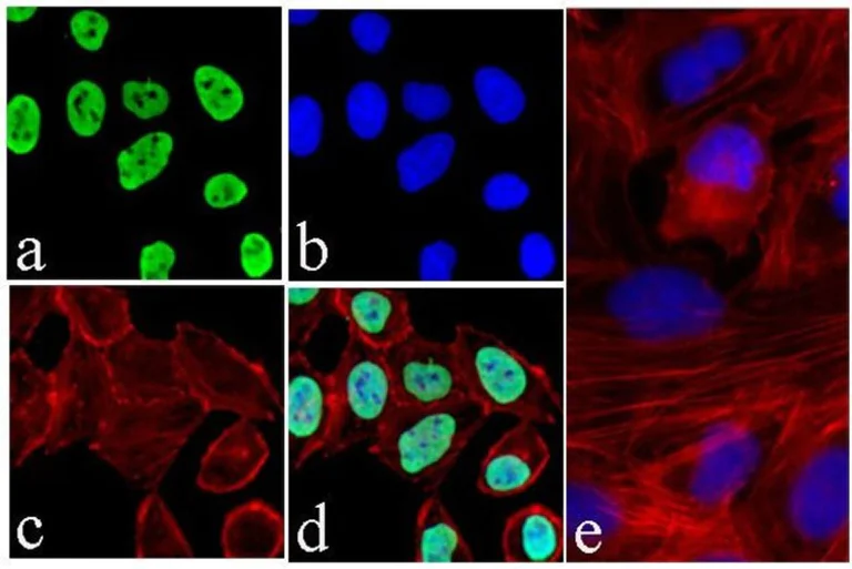 Immunocytochemistry - Anti-Survivin 3 alpha antibody [9H18L32] (AB203571)