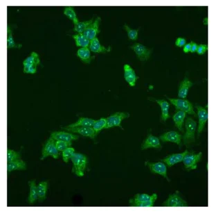 Immunocytochemistry - Anti-Survivin 3 alpha antibody [9H18L32] (AB203571)