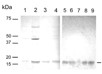 Western blot - Anti-Survivin 3 alpha antibody [9H18L32] (AB203571)