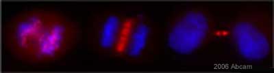 Immunocytochemistry/ Immunofluorescence - Anti-Survivin antibody (ab469), expandable thumbnail