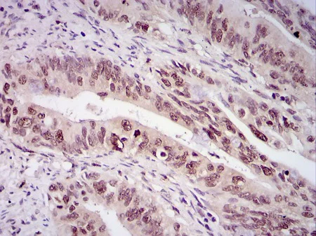 Immunohistochemistry (Formalin/PFA-fixed paraffin-embedded sections) - Anti-Survivin antibody (AB469)