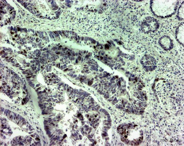 Immunohistochemistry (Formalin/PFA-fixed paraffin-embedded sections) - Anti-Survivin antibody (ab469), expandable thumbnail