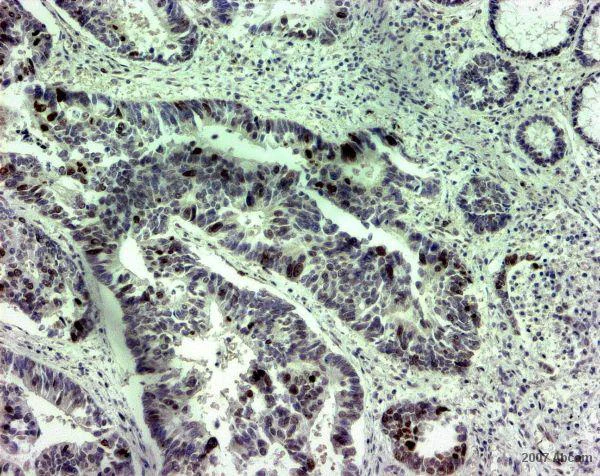 Immunohistochemistry (Formalin/PFA-fixed paraffin-embedded sections) - Anti-Survivin antibody (AB469)